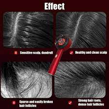 Electric Scalp Massager - Relaxation & Hair Growth Boost